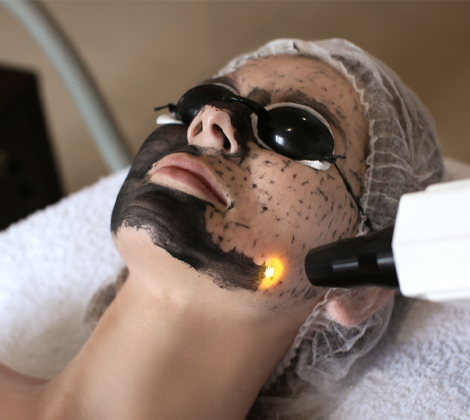 Laser Skin Rejuvenation